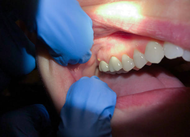 Best Broken or Cracked Tooth Emergency Dentist in Greenock, PA